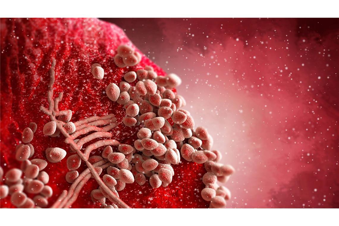 3D-Illustration vom Bakterium Staphylococcus aureus auf menschlicher Haut.