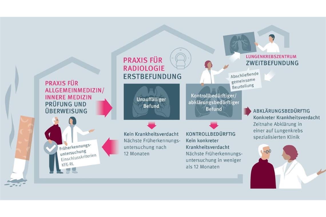 Ablauf des Lungenkrebs-Screenings, das seit 1. April 2026 von den gesetzlichen Krankenkassen für Risikopatienten eingeführt worden ist.