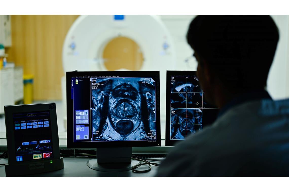 Krebsrisiko lässt sich um bis zu 40 Prozent senken Auf dem Monitor ist das Querschnittsbild einer Prostata zu sehen: Prostatakrebs gehört zu den häufigsten Krebsarten bei Männern. (Archivbild)