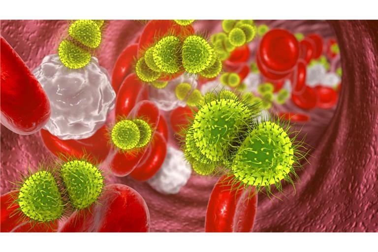 Bakterien der Gruppe „Neisseria meningitidis“, auch Meningokokken genannt, verursachen eine eitrige Hirnhautentzündung (Meningitis), mitunter auch eine Blutvergiftung (Sepsis).