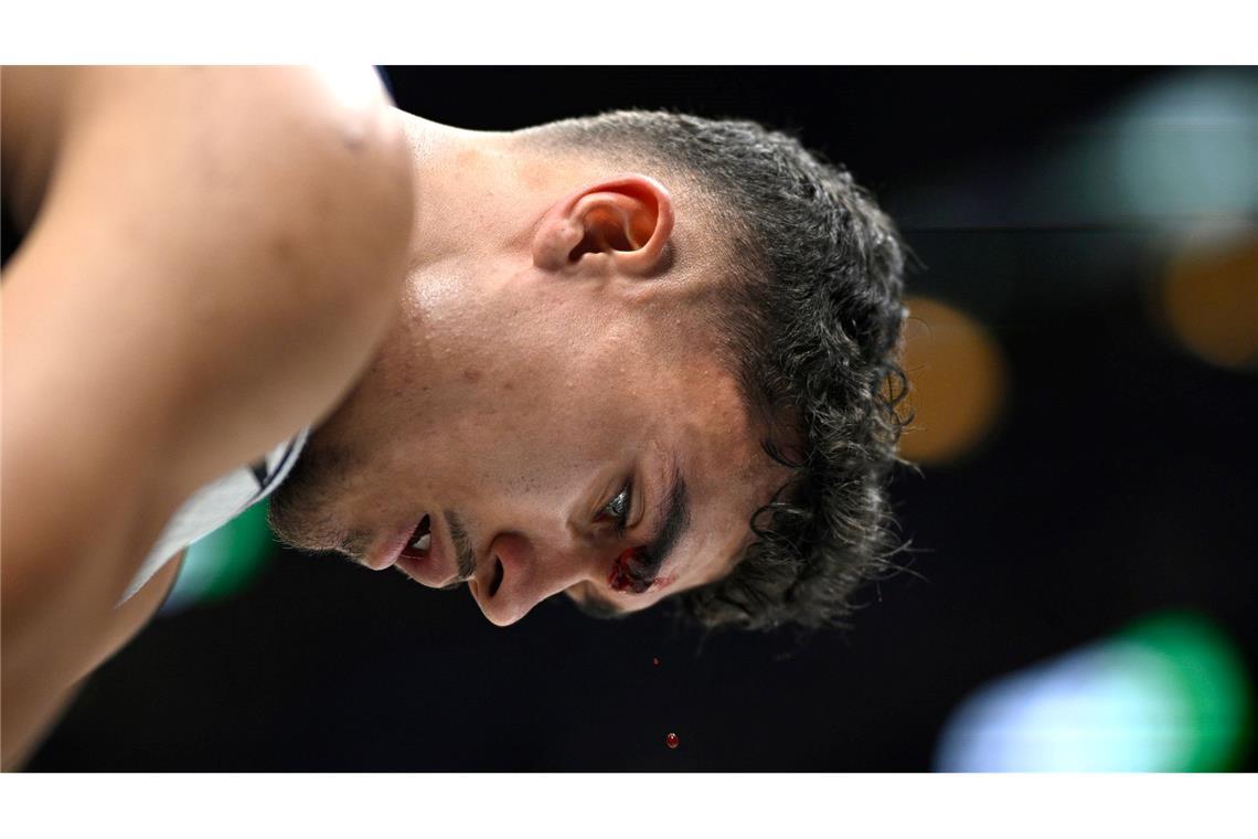 Bilder des Tages Blut tropft vom Gesicht von Orlando Magic-Stürmer Tristan da Silva.