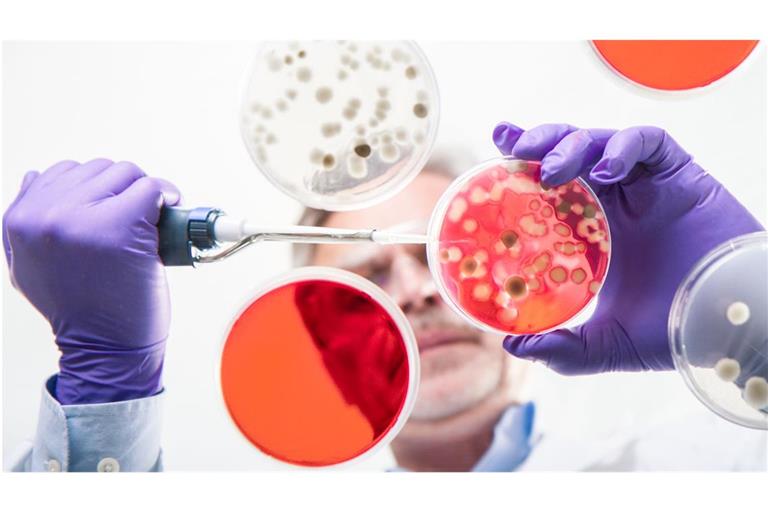 Damit auch in Zukunft effektive Medikamente gegen bakterielle Infektionserkrankungen verfügbar sind, werden Antibiotika benötigt, die andere Zielstrukturen der Bakterien adressieren als alle Wirkstoffe, die bereits klinisch verwendet werden (Symbolfoto).