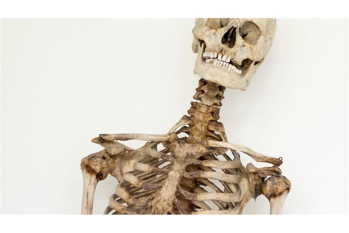 So flog die Skelett-Verwechslung beim Schinderhannes auf Dank wissenschaftlicher Analysen und eines Verwandten weiß man nun, dass dieses Skelett die sterblichen Überreste des Räubers Schinderhannes sind.