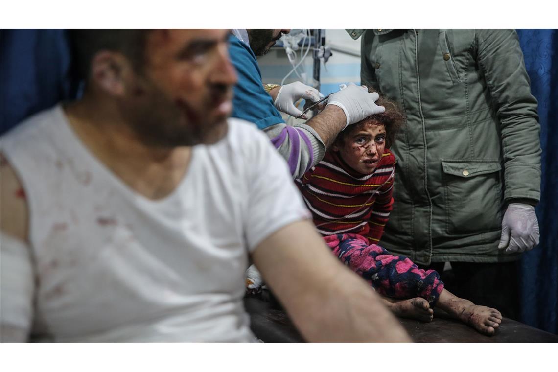 dpa-Fotograf Alkharboutli in Syrien getötet Das Foto des dpa-Fotografen Anas Alkharboutli zeigt ein verletztes sechsjähriges Mädchen.