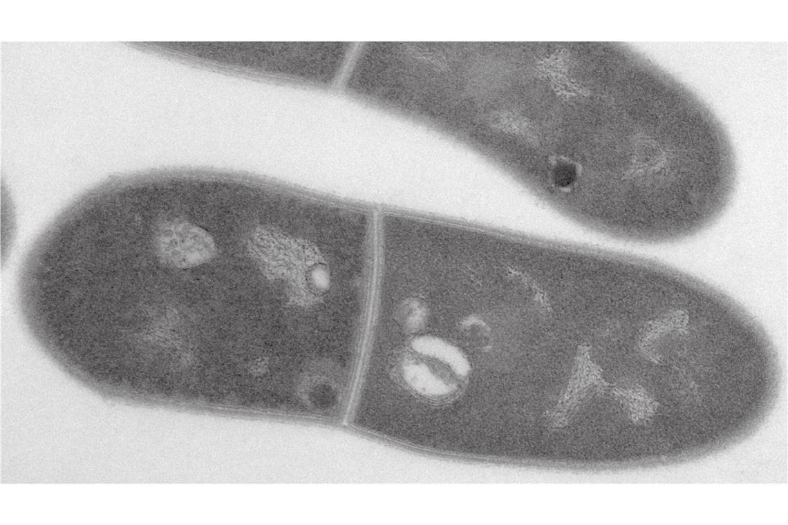 Glutamat-Produzent zur „Mikrobe des Jahres“ gewählt Das undatierte Handout zeigt eine Transmissionselektronenmikroskopische Aufnahme eines Bakteriums Corynebacterium glutamicum mit Speicherstoffen wie Polyphosphat und Lipidtröpfchen.