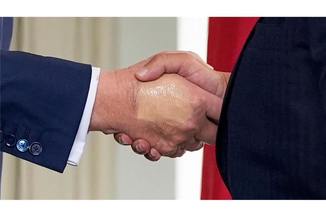 Weißes Haus: Trump hat chronische Erkrankung der Beinvenen Das Weiße Haus gibt Details zu Trumps Gesundheitszustand preis.