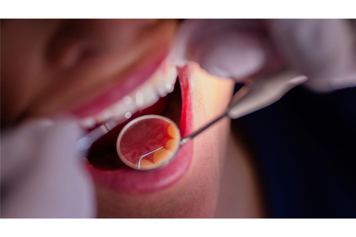 Der Wirtschaftsrat der CDU schlägt vor, Zahnbehandlungen aus dem Leistungskatalog der gesetzlichen Krankenversicherung zu streichen (Symbolfoto).