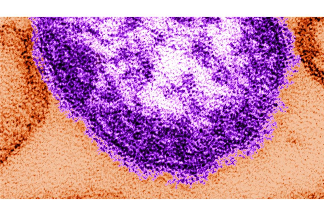 Die Abbildung mit Hilfe eines Transmissionselektronenmikroskops zeigt Teile eines Masernvirus