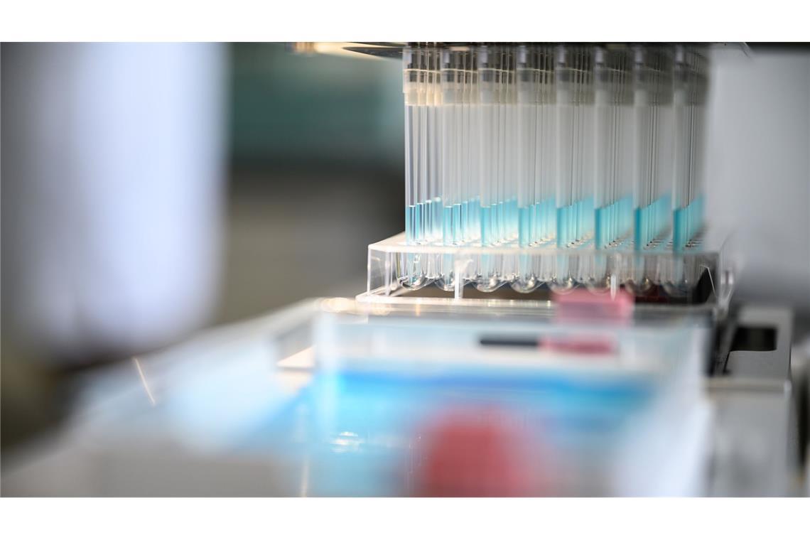 EU-Richtlinie gefährdet deutsche Medikamentenversorgung Die Abwasserreinigung soll gründlicher werden – auf Kosten der Pharma- und Kosmetikindustrie.