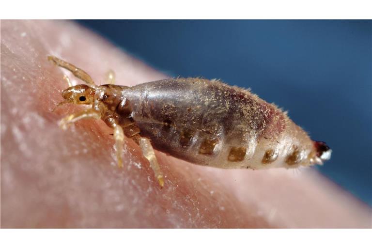 Die Kleiderlaus ist ein auf den Menschen spezialisierter blutsaugender Ektoparasit und  Überträger von Krankheitserregern wie dem Pest-Bakterium.