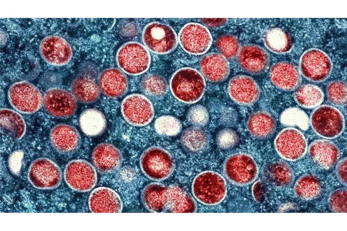 WHO: Neue Mpox-Variante erstmals in Europa übertragen Die Weltgesundheitsorganisation (WHO) hatte im August wegen der zunehmenden Mpox-Verbreitung in Afrika eine "Gesundheitliche Notlage internationaler Reichweite" erklärt.