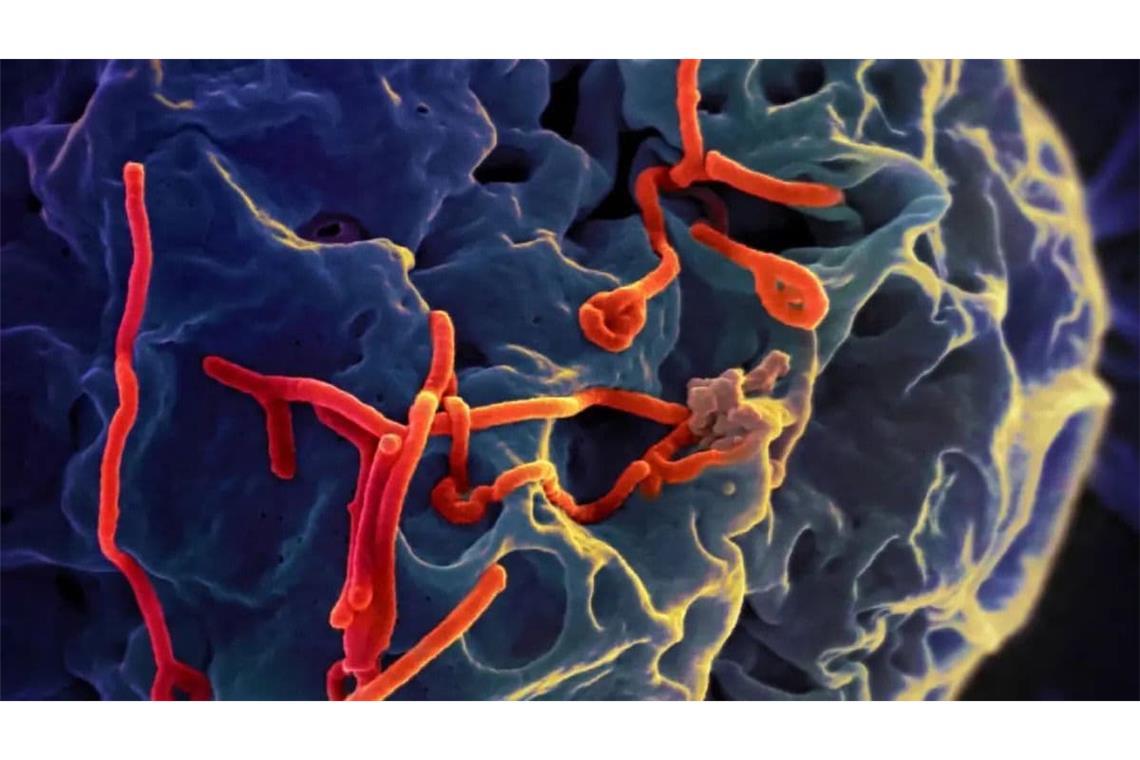 Ebolaviren-Partikel (rot) auf einer menschlichen Zelle.Foto: 