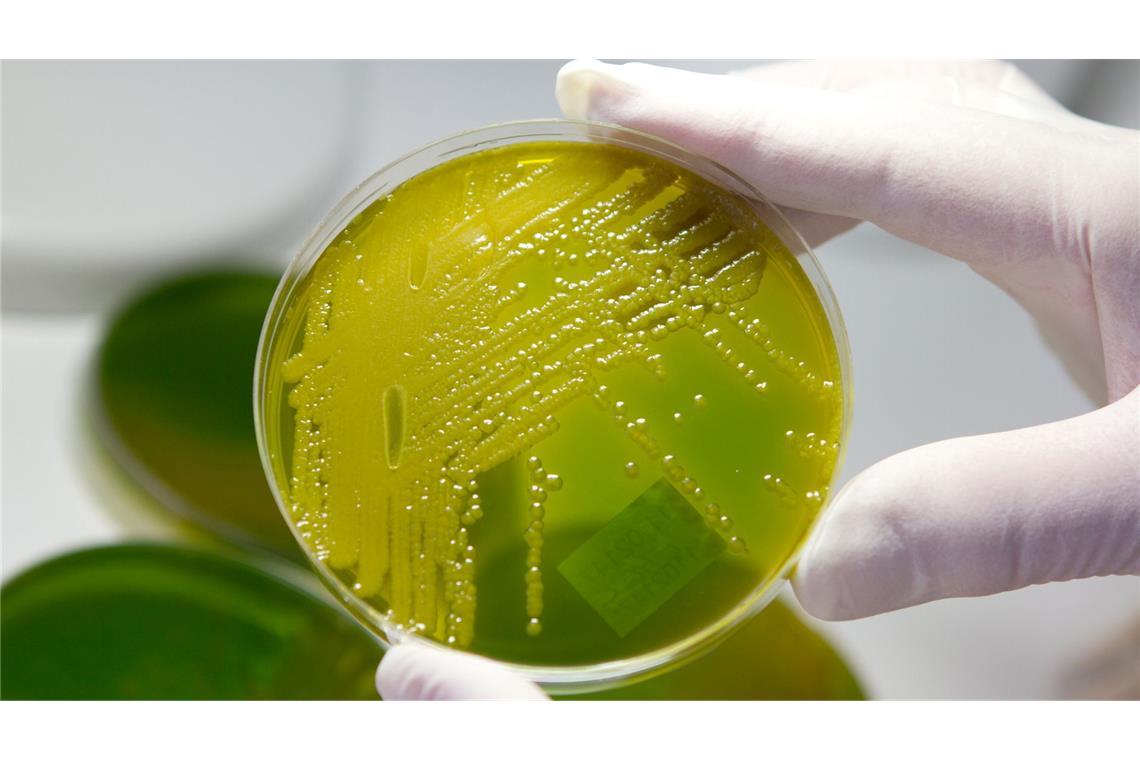 Häufung von Ehec-Infektionen - wie gefährlich ist das? Ehec steht für enterohämorrhagische Escherichia coli und bezeichnet bestimmte krankmachende Stämme des Darm-Bakteriums, die vor allem bei Wiederkäuern wie Rindern vorkommen. (Archivbild)