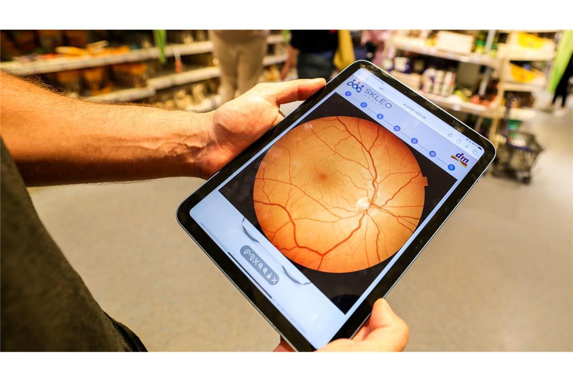 Gesundheitsangebote in der Drogerie - dm kontert Kritik Ein Foto zeigt Details der Netzhaut.