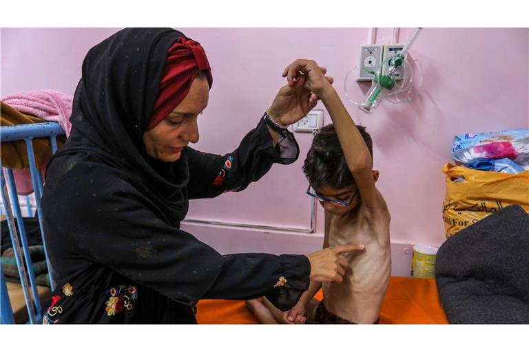 Ein palästinensisches Kind, das an schwerer Unterernährung leidet, wird von seiner Mutter im Nasser Medical Hospital gehalten. Israel hält die Grenzübergänge weiterhin geschlossen und lässt humanitäre Hilfe und Säuglingsnahrung nicht in den Gazastreifen.