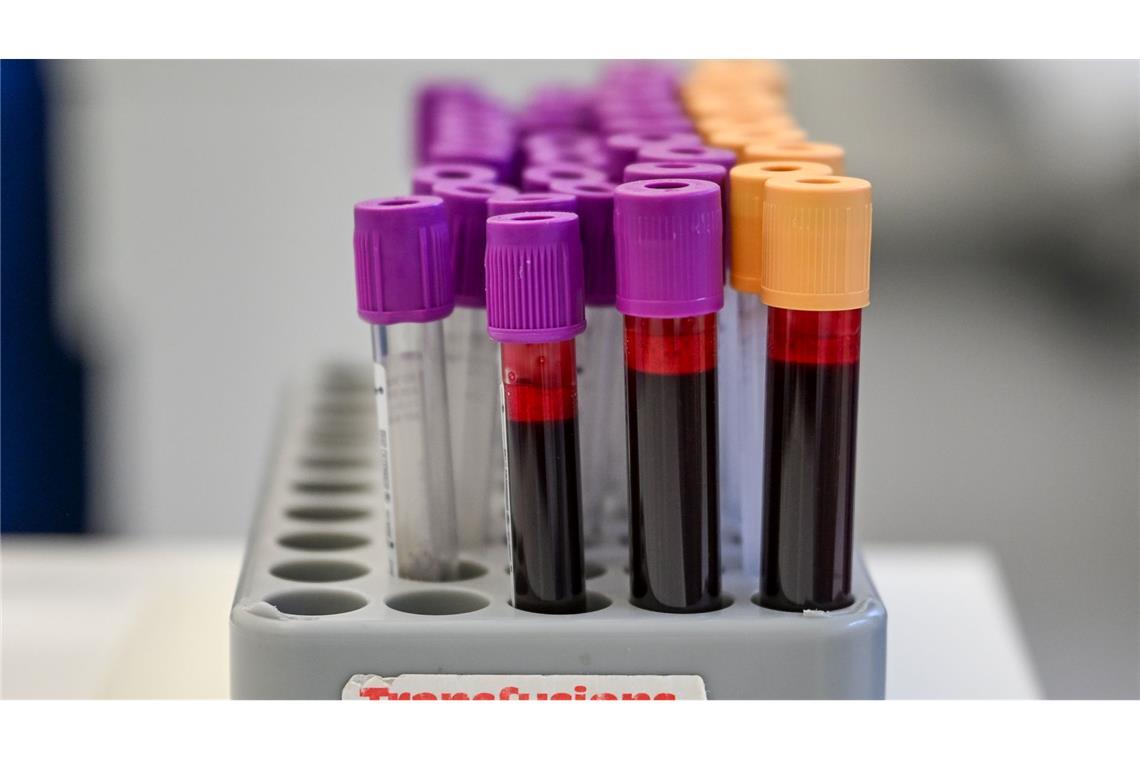 Eine Blutspende kann bis zu drei Menschen helfe (Symbolbild).