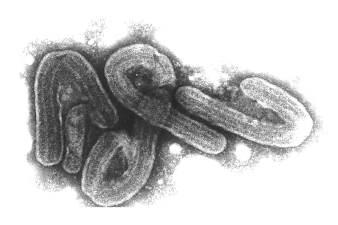 WHO: Offenbar acht Tote durch Marburg-Virus in Tansania Eine elektronenmikroskopische Aufnahme des Marburg-Virus.