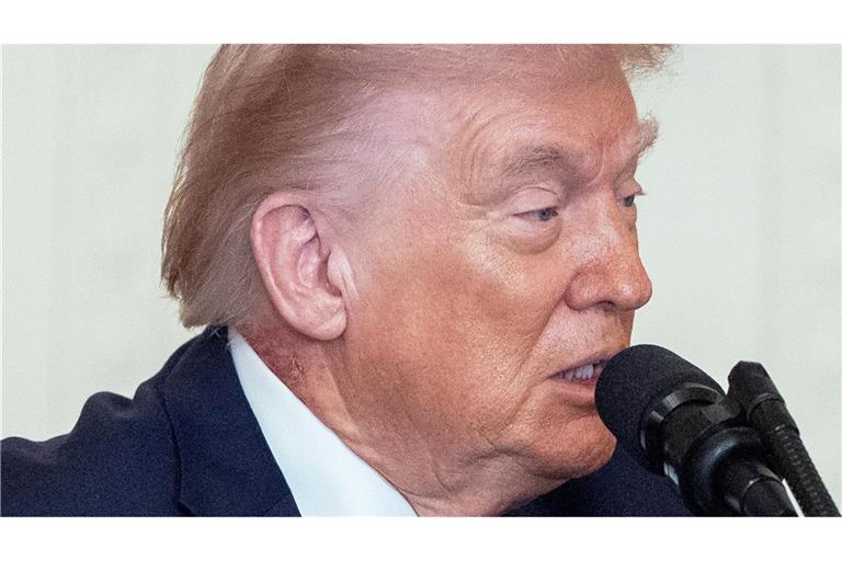 Eine Stelle an Trumps Hals hat eine Welle von Spekulationen über die Gesundheit des Präsidenten ausgelöst.