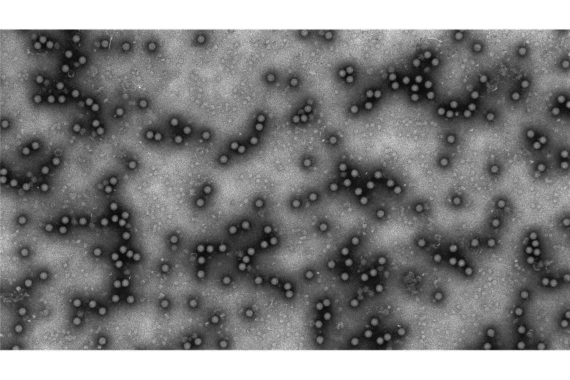London verhängt Importverbot für deutsche Huftiere Elektronenmikroskopische Aufnahme des Maul- und Klauenseuche-Virus