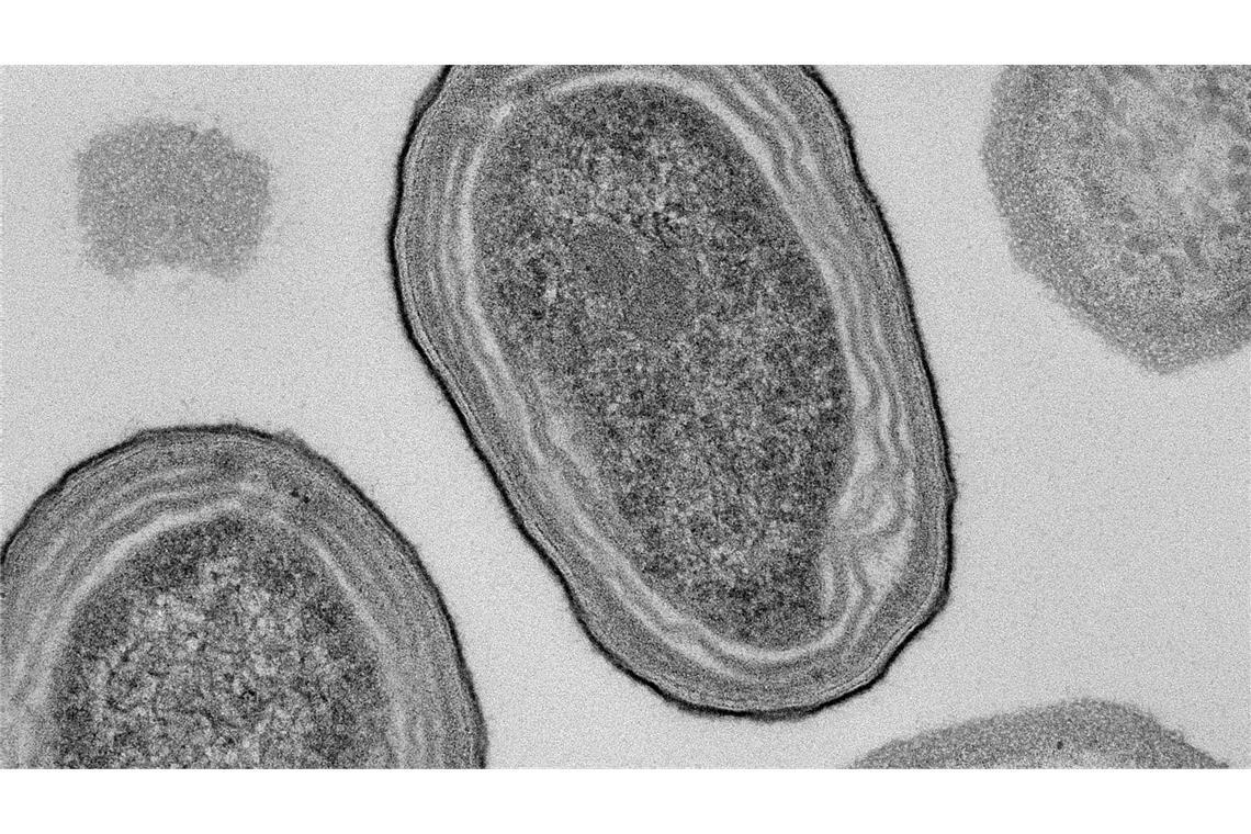 Elektronenmikroskopische Aufnahme von Prochlorococcus-Zellen.