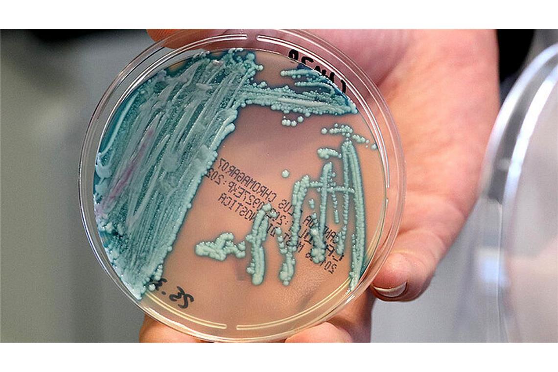 Für gesunde Menschen ist der Pilz in der Regel ungefährlich, bei Menschen mit einem geschwächten Immunsystem oder Patienten auf Intensivstationen ist die Gefahr größer: der Hefepilz Candidozyma auris, hier in der Petrischale gezüchtet, breitet sich in Deutschland aus.