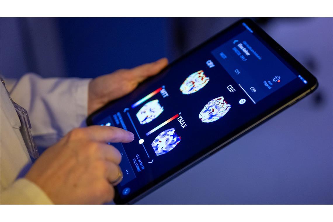 Gehirnbilder eines Patienten in einer KI-basierten App. Nach einer Deloitte-Umfrage sehen viele Bürgerinnen und Bürger den Einsatz von KI in der Medizin skeptisch, vor allem wenn es um die Therapie geht. (Symbolbild)
