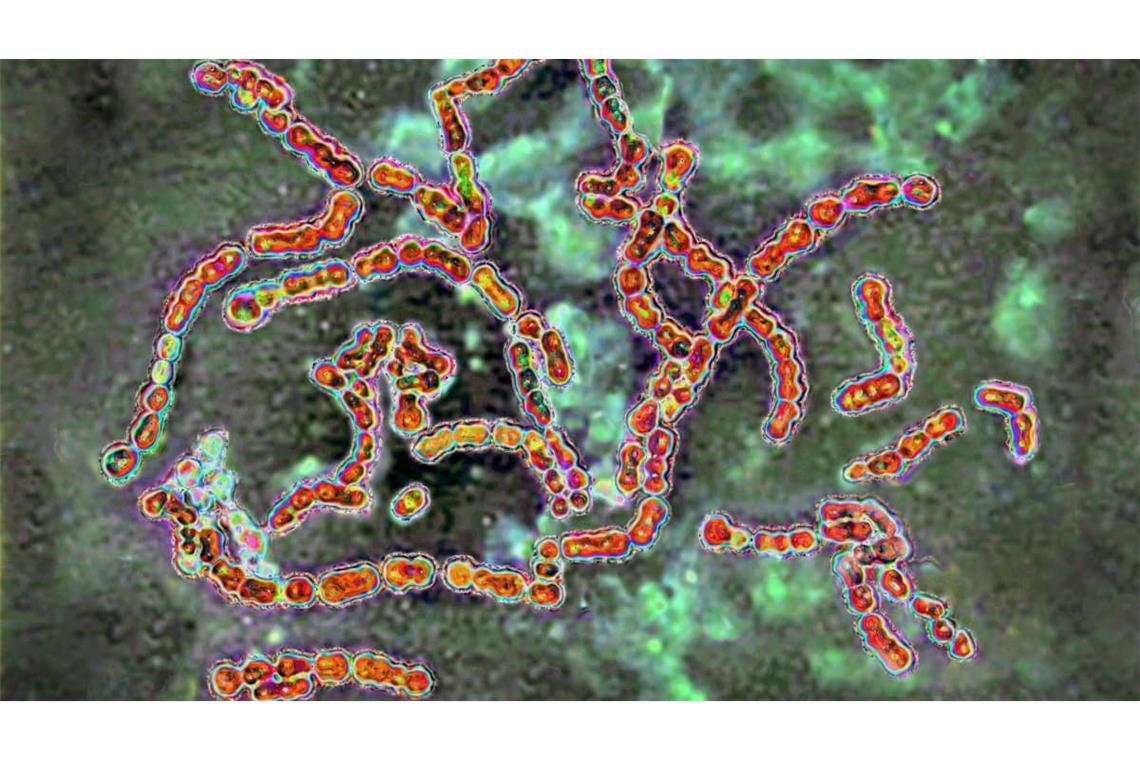Gruppe A streptococci pyogenes