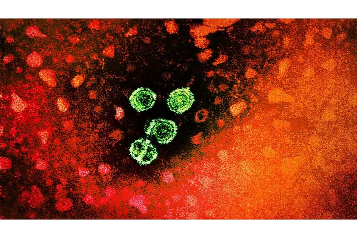 Hepathitis Typ C-Virus