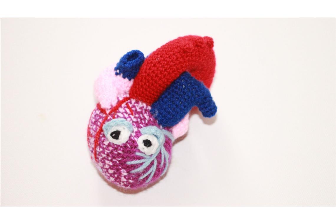 Herzmine von Bland-White-Garland - Herz mit ALCAPA-Syndrom (Anomalous Left Coronary Artery from the Pulmonary Artery). Spitzname und Lieblingstier: Alpaca. Ihr Lieblingssong: „heart attack“ von Demi Lovato. Ihre Stärke: versucht immer alles (auch jedes Sauerstoffmolekül) aus sich heraus zu holen. Ihre Schwäche: sehr schreckhaft und bekommt schnell einen Herzinfarkt