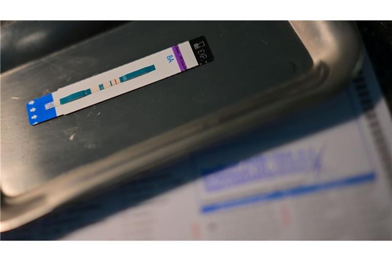 HIV-Diagnosen werden oft erst Jahre nach der Infektion gestellt. (Symbolbild)