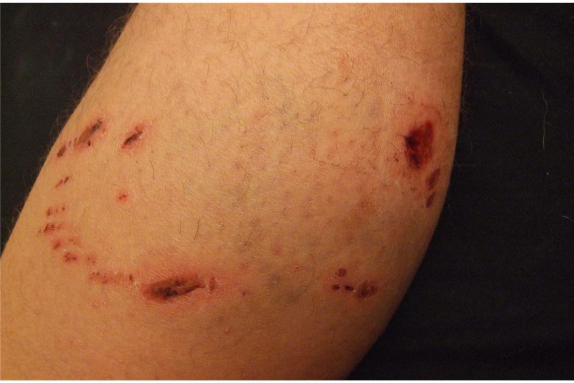 Hundebiss nach drei Tagen.