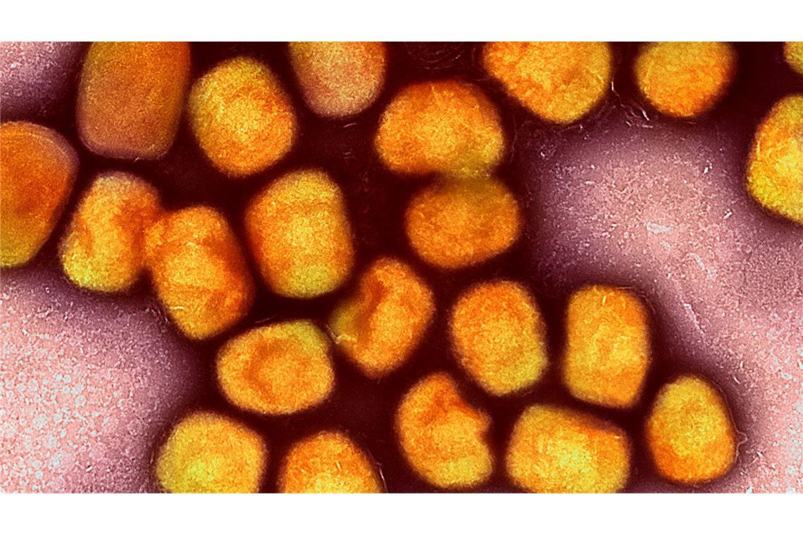 Wegen Mpox: Schule in NRW vorsorglich geschlossen In Deutschland ist zum zweiten Mal die neue Variante des Mpox-Virus nachgewiesen worden, vier Mitglieder einer Familie im Rheinisch-Bergischen Kreis bei Köln sind erkrankt (Archivbild).