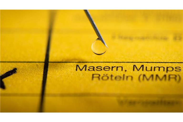 In Karlsruhe ist es zu einem Masernausbruch gekommen. (Symbolbild)