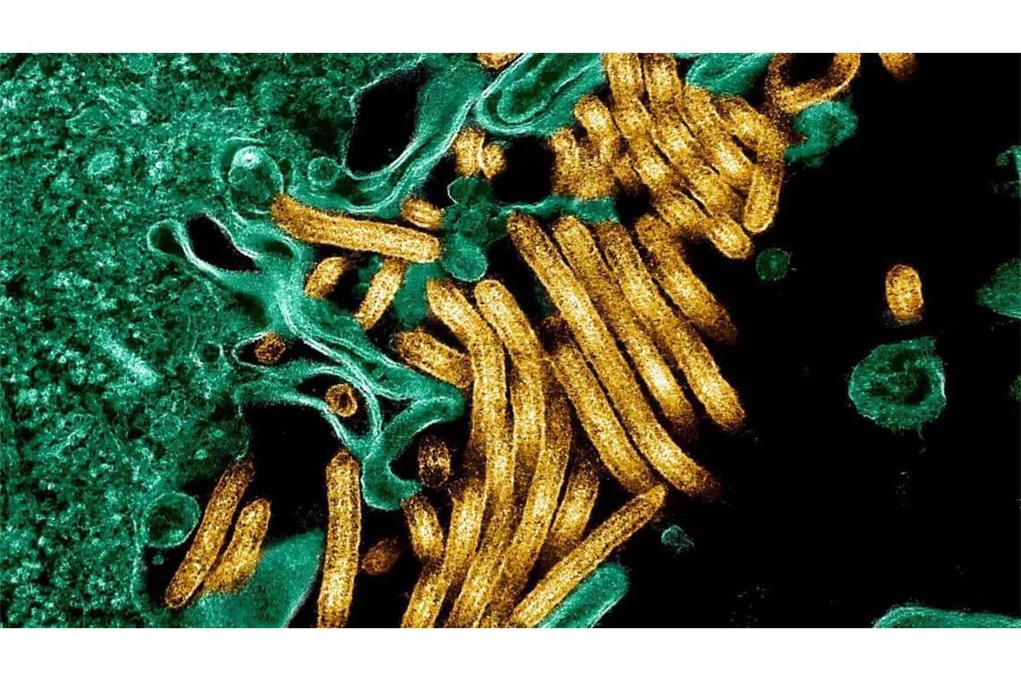 Kolorierte Aufnahme von Ebolaviren mit dem Elektronenmikroskop.