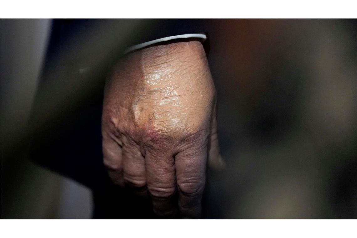 Weißes Haus: Trump am Freitag zu Gesundheits-Check Nachdem der Bluterguss am Handrücken für Aufsehen sorgte, wurde er häufig bei Auftritten zugeschminkt. (Archivbild)