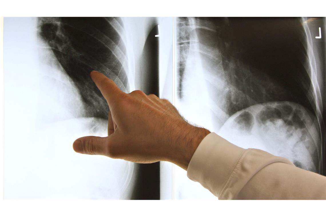 Patientenschützer sind über die geplanten Neuregelungen bei der Ärztewahl besorgt. (Archivbild)