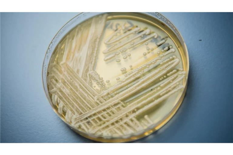 Petrischale mit Hefepilz Candidozyma auris: Auf Intensivstationen besonders gefährlich