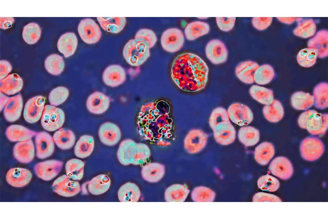 Plasmodium falciparum