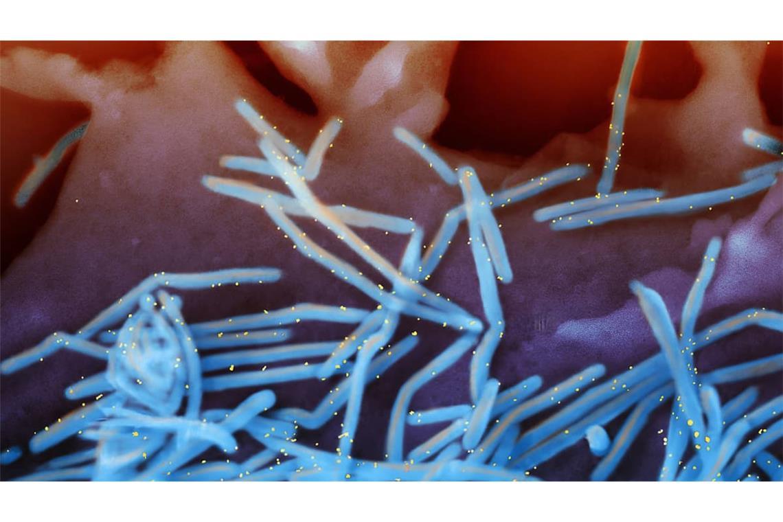 Respiratorisches Synzytial-Virus