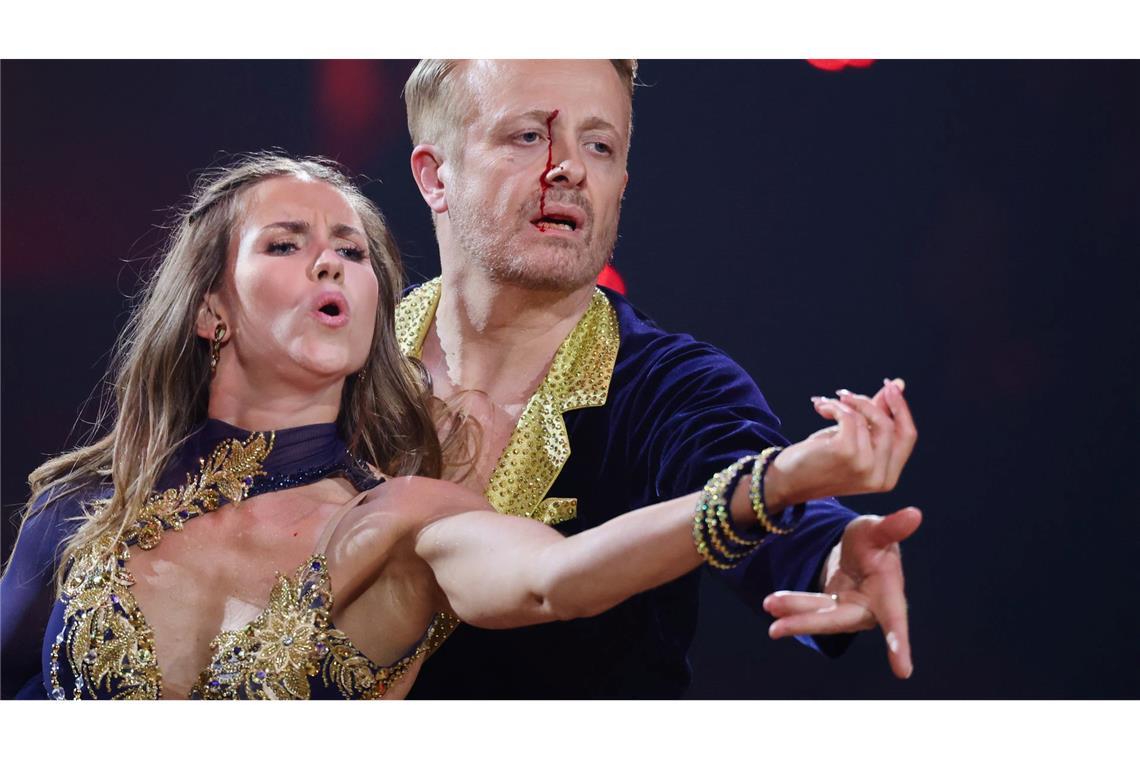 Ross Antony ist eine Runde weiter - obwohl ihm nach einem kleinen Unfall Blut über das Gesicht lief.