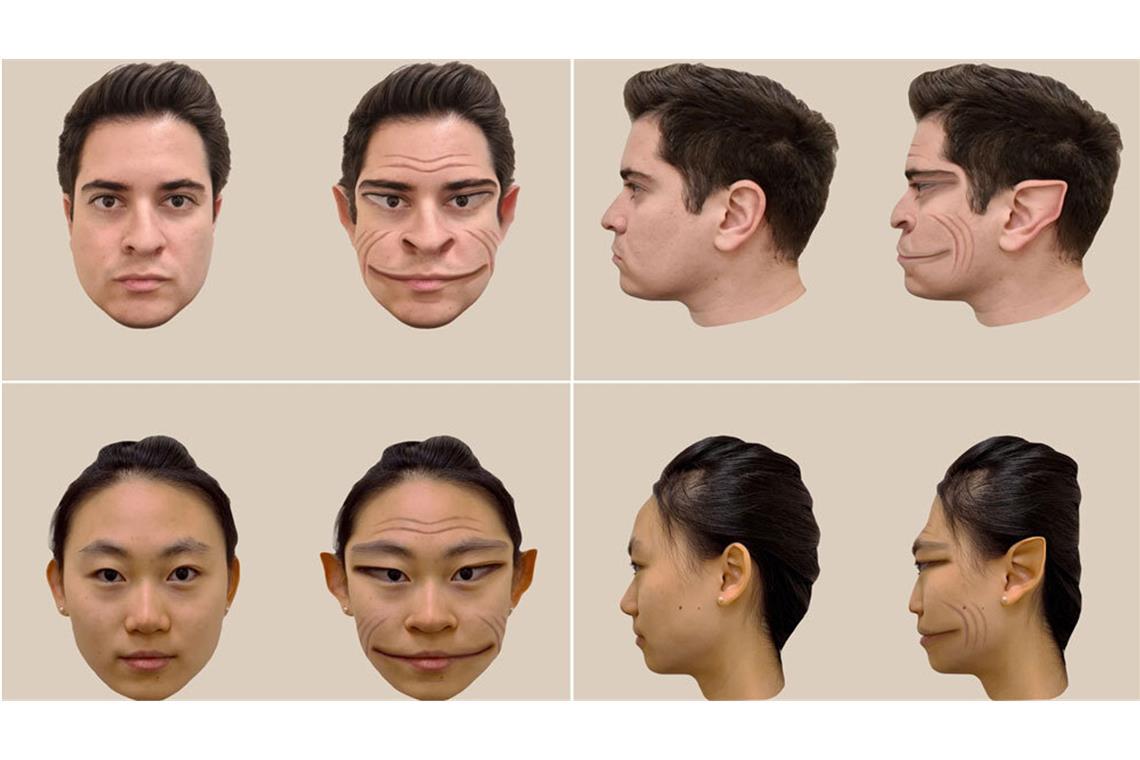 So dämonisch verzerrt nimmt ein 58-jähriger Amerikaner, der an der äußert seltenen Nervenerkrankung Prosopometamorphopsie leidet, die Gesichter anderer Menschen wahr.