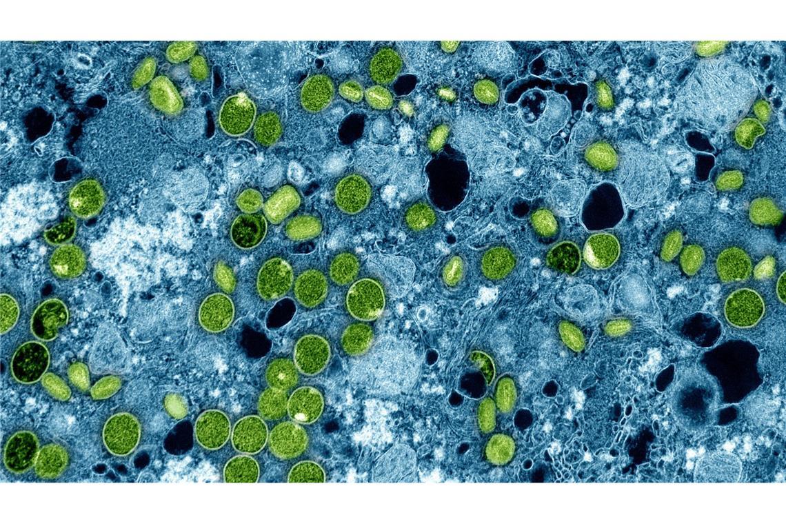 Schulschließung wegen Mpox - Was bedeutet das? So sehen die Mpox-Viruspartikel unter dem Mikroskop aus. (Archivbild)