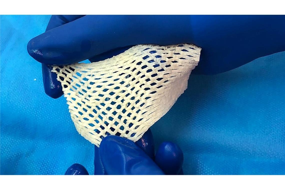 Wichtige Alternative für Hautttansplantationen: Fischhaut.