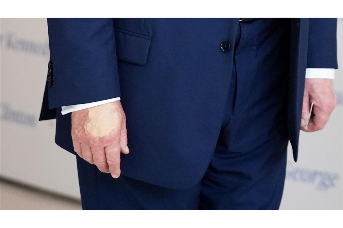 Trump erneut mit Bluterguss an der Hand fotografiert Zuvor zeigten Fotos den Bluterguss offenbar mit Make-up überschminkt. (Archivbild)